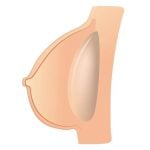Hollow Breast