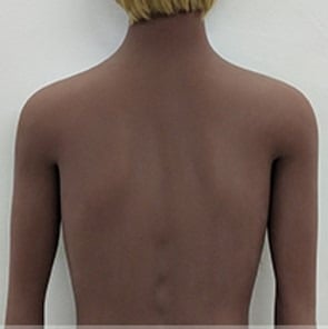 Option 2