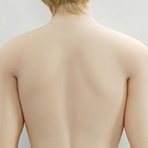 Option 7