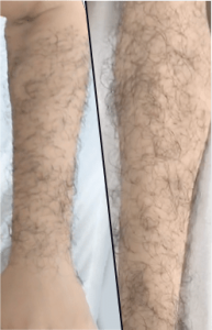 Arm