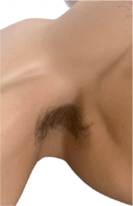 Armpit