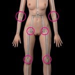 Limb Weakness