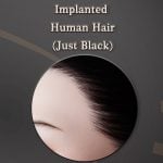 Implanted Human Hair