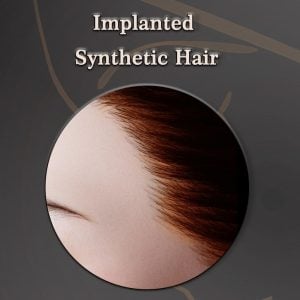 Implanted Hair