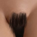 Implant Pubic Hair