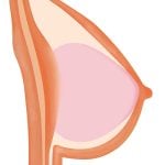 Gel Breasts (free)