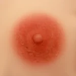 7CM