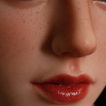 Freckles