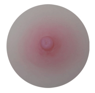 Areola Color-Pink