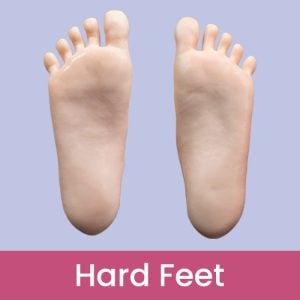 Hard Feet Standing without Bolts