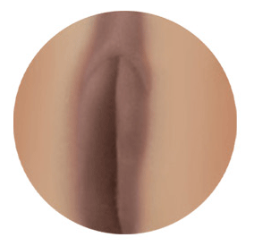 Labia Color-Dark Brown