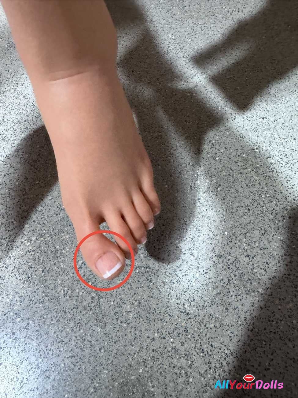 Loose toe