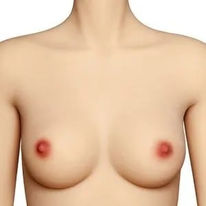 Normal Skin