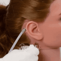 Oral Heating