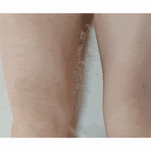 Whole Body Skin Texture