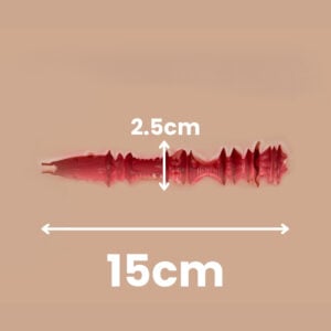 03 Vaginal Channel