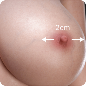 2CM