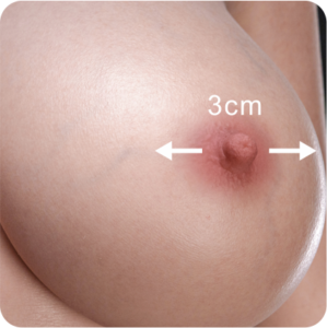3CM
