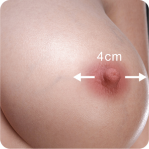 4CM