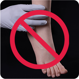 No Hard Feet
