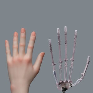 Grace Finger Upgrade