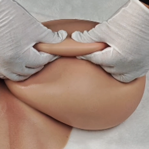 0.8–1.5 cm Breast Skin (Balanced)