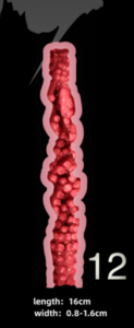 T12